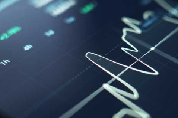 杜家升：黄金跌至未止，反弹继续高空